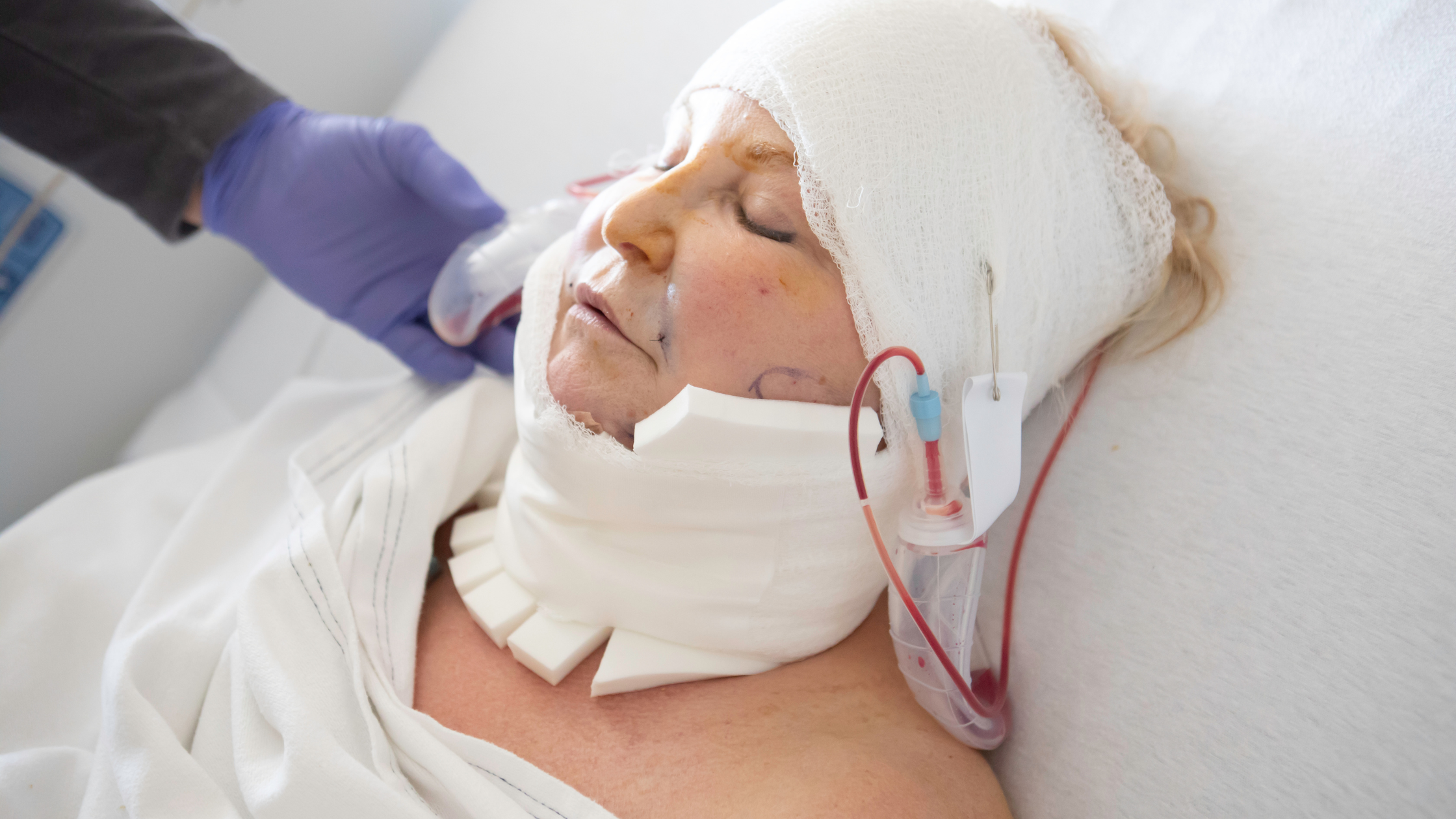 Understanding Traumatic Brain Injury and Its Societal Impact